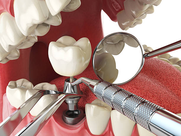 Best Emergency Tooth Extraction  in Carpendale, WV